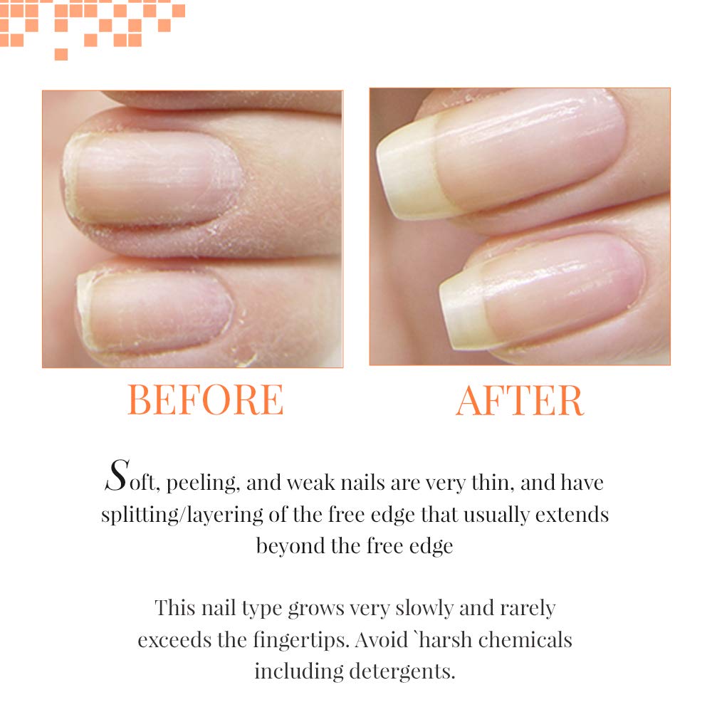 NAIL TEK Los expertos en uñas naturales para unas uñas sanas