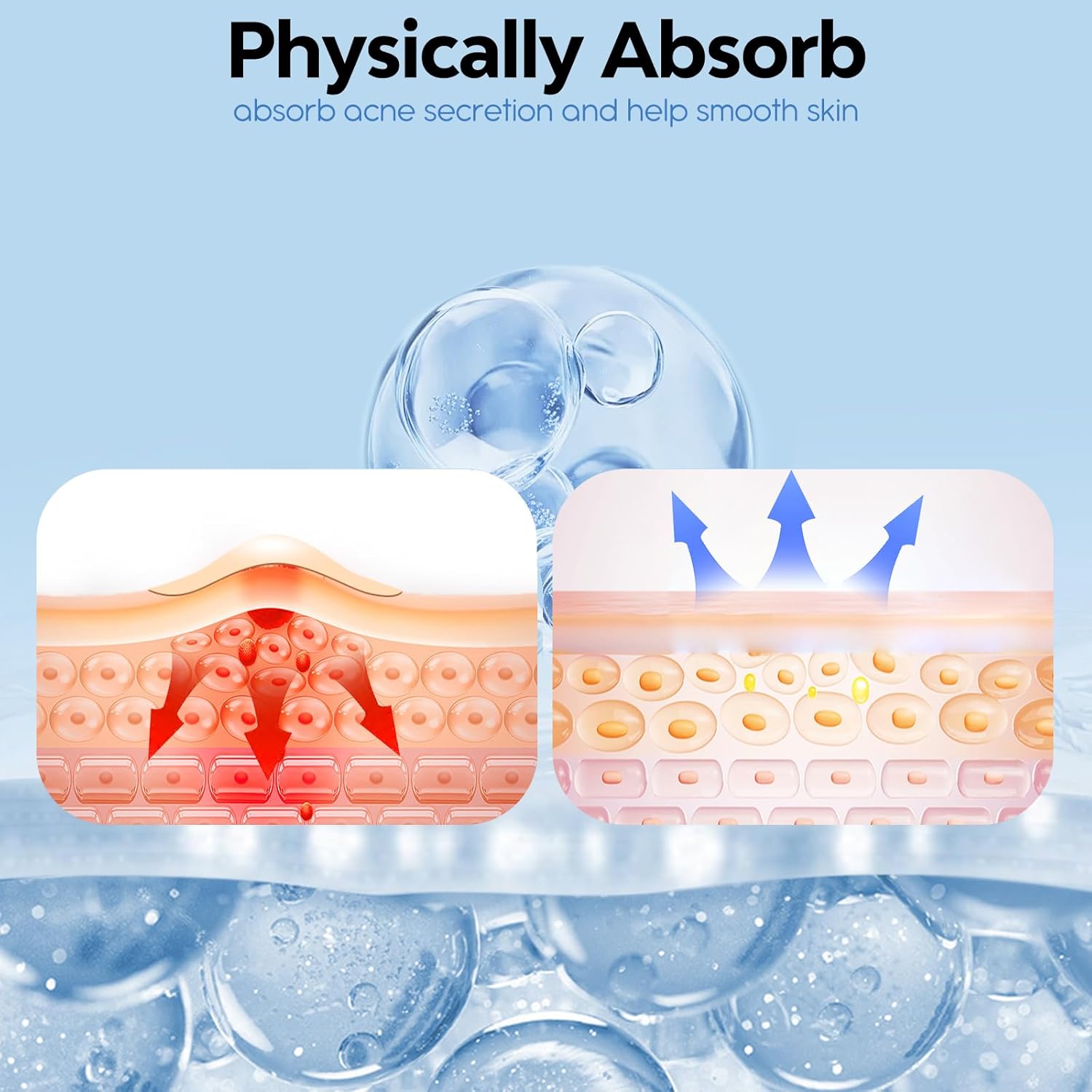 BREIBOZ Day and Night Acne Pimple Patches