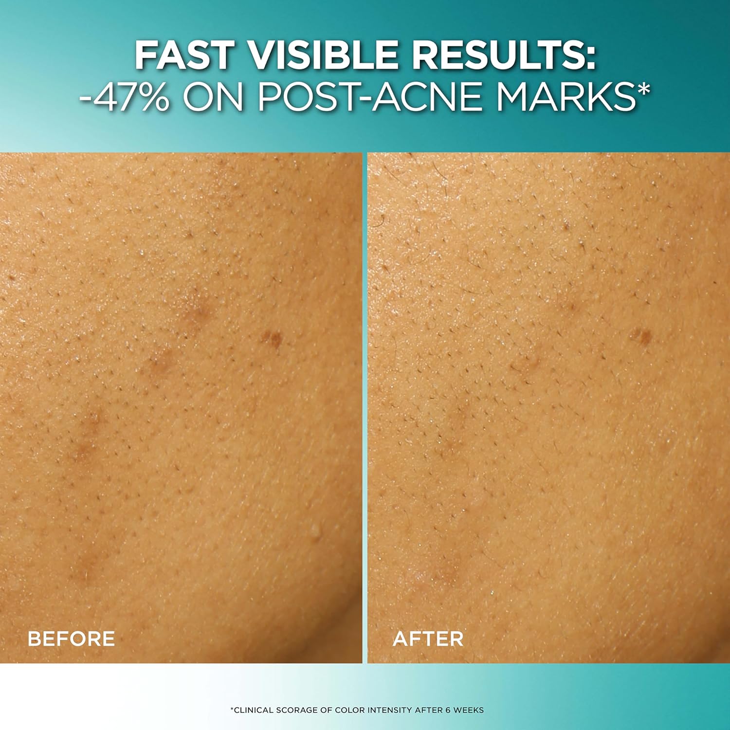 L'OREAL Bright Reveal Dark Spot Exfoliant Peel