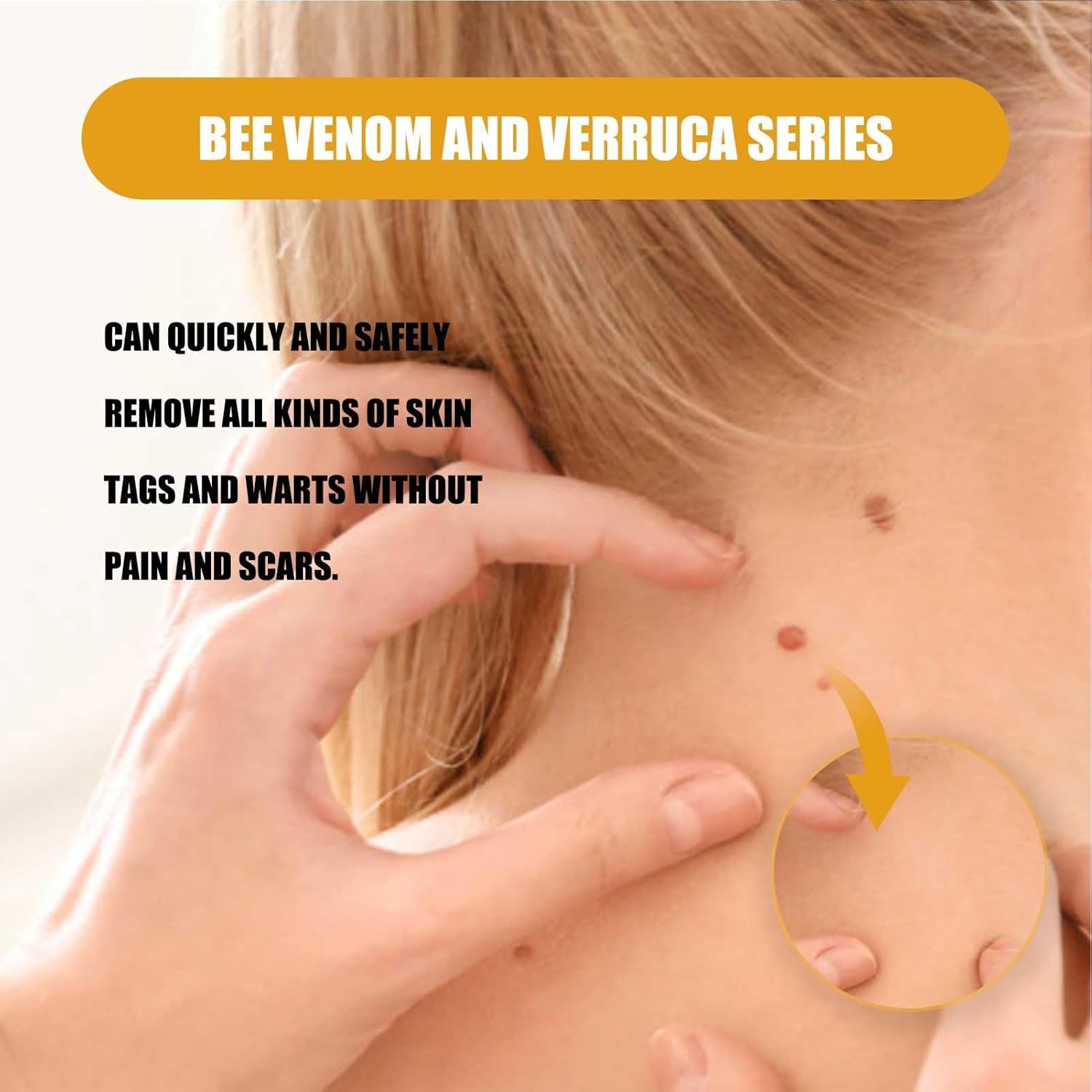 BEE VENOM Moles and Warts Treatment Cream
