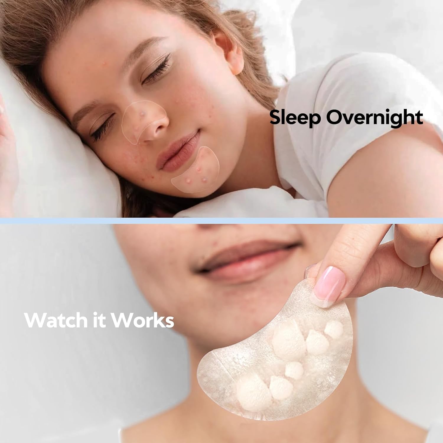 BREIBOZ Day and Night Acne Pimple Patches