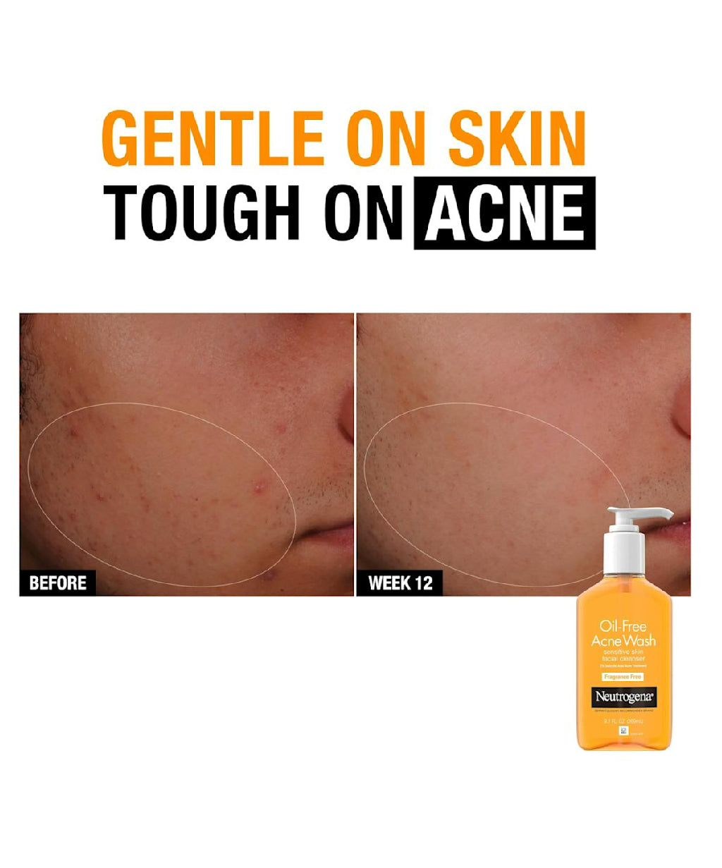 NEUTROGENA Oil-Free Acne Wash