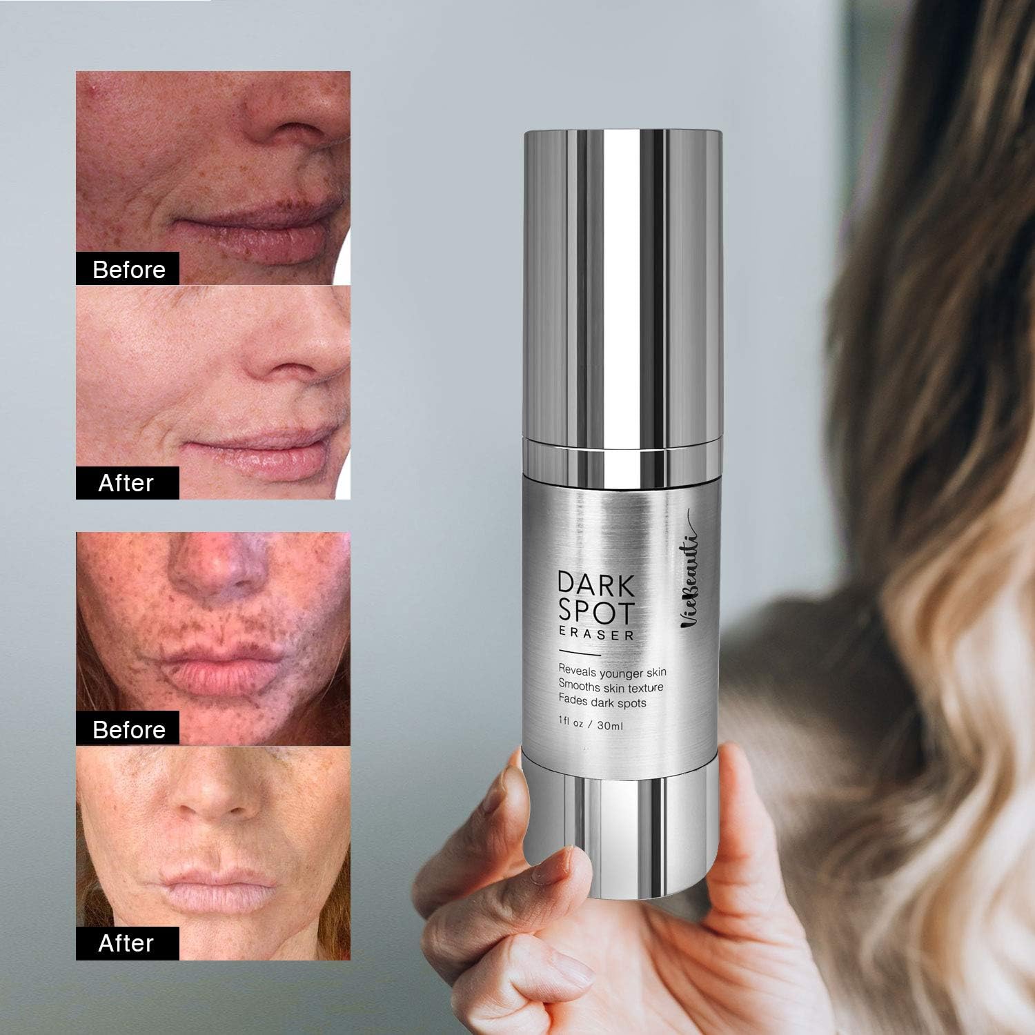 Dark Spot Corrector Serum