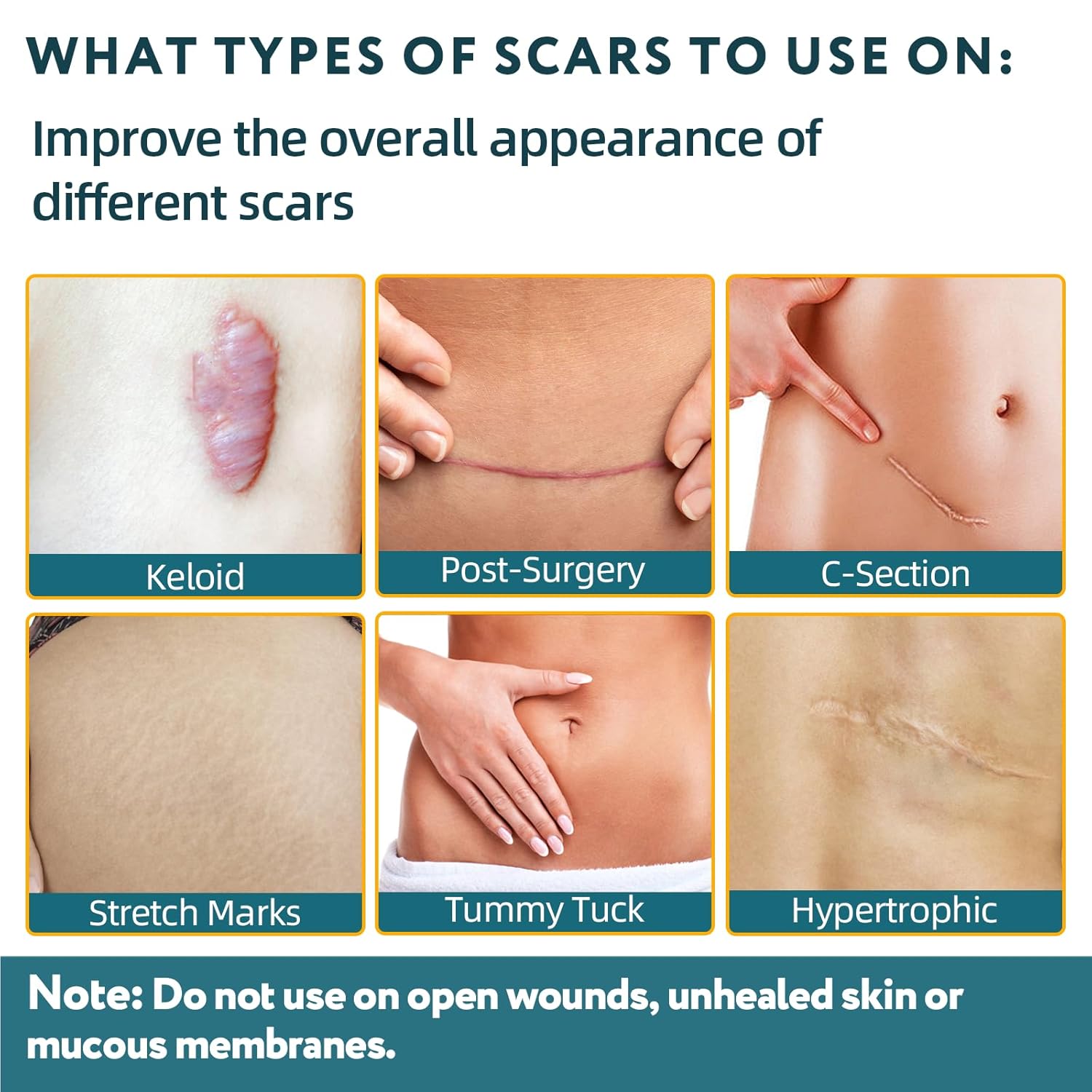 R'NT Silicon Premium Scar Sheets
