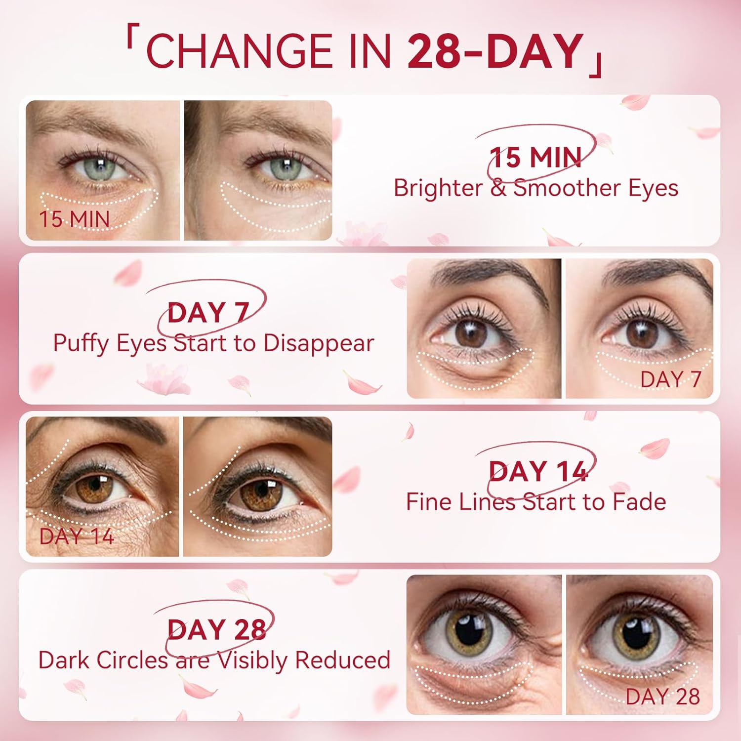 BREYLEE Rose Eye Mask