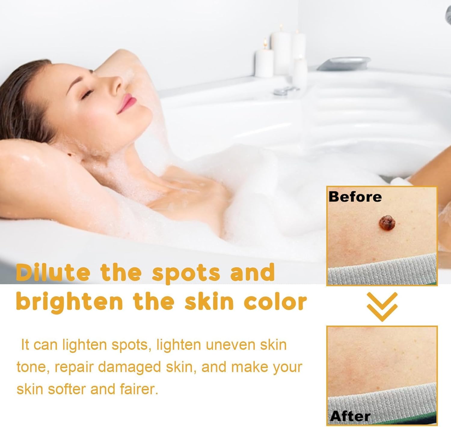 BEE VENOM Moles and Warts Treatment Cream