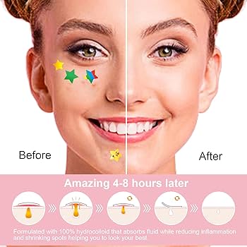 STARFACE Hydro-Stars Pimple Patches (Limited Edition)