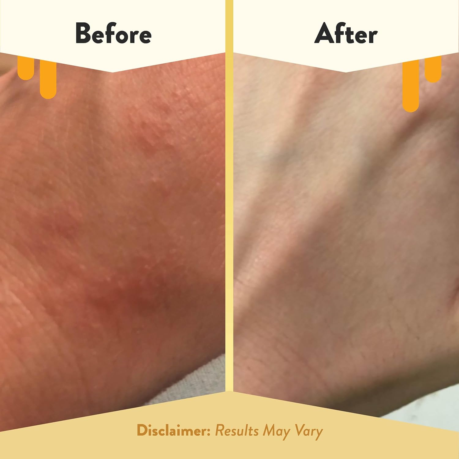 ECZEMA HONEY Oatmeal Full-Body Moisturizing Lotion