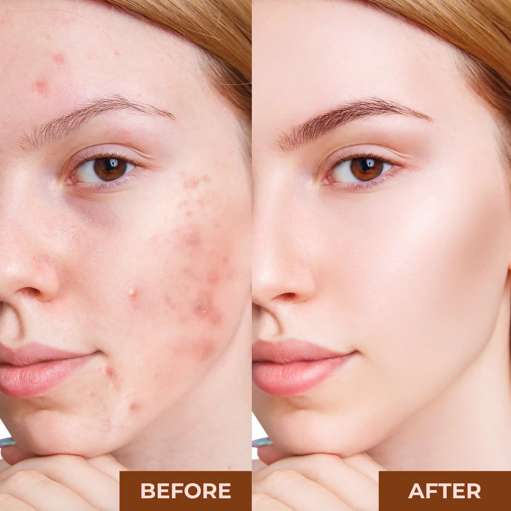 Best Pore Minimizing Primer by Prolux