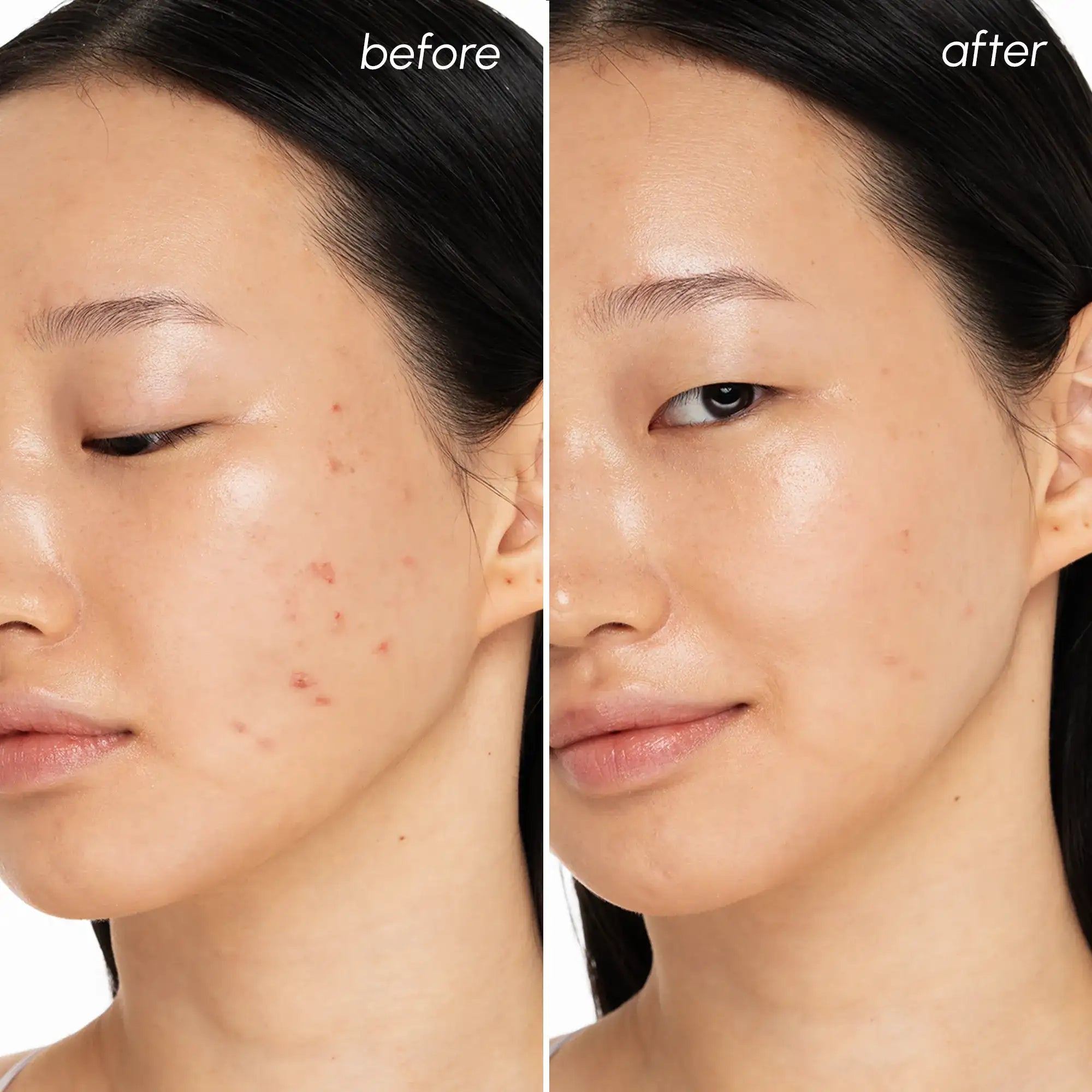 Witch Hazel Clearing Pads