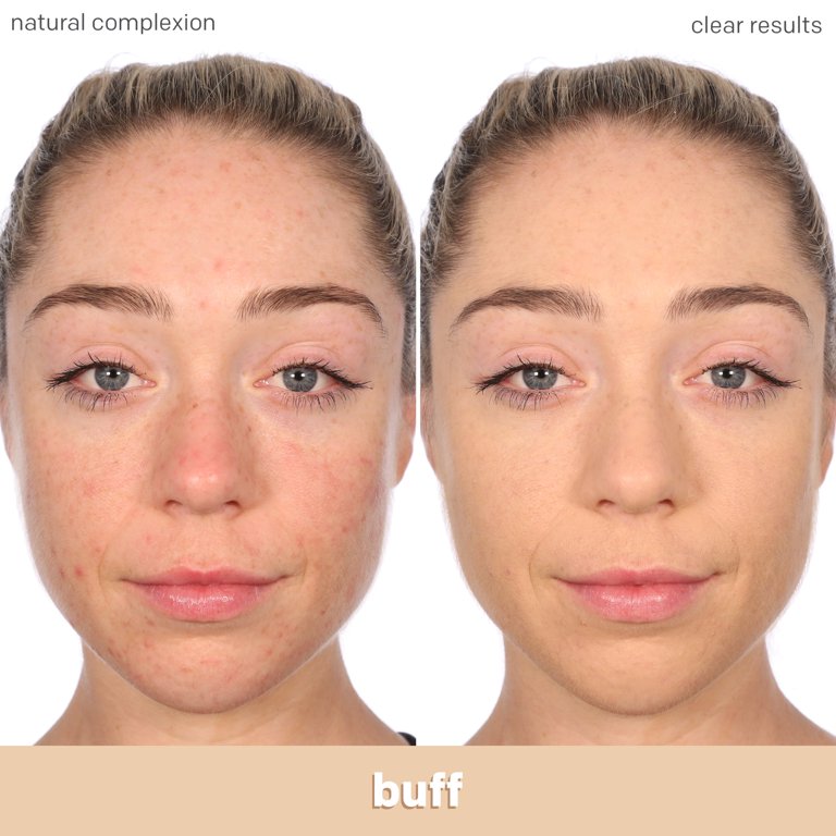 ALMAY Clear Complexion 4 in 1 Blemish Eraser Foundation